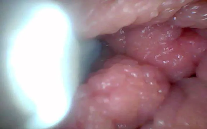 Twittiy: Endoscope Camera Shows the Most Sensitive Parts of the Penis...