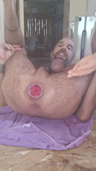 Ass Dilation