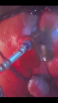 Intense Verbal Play Ahead...