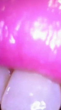 Deep Inside Sydney's Mouth - Sydney Screams Shows off Mouth, Tongue, Throat, and Uvula with Endoscope