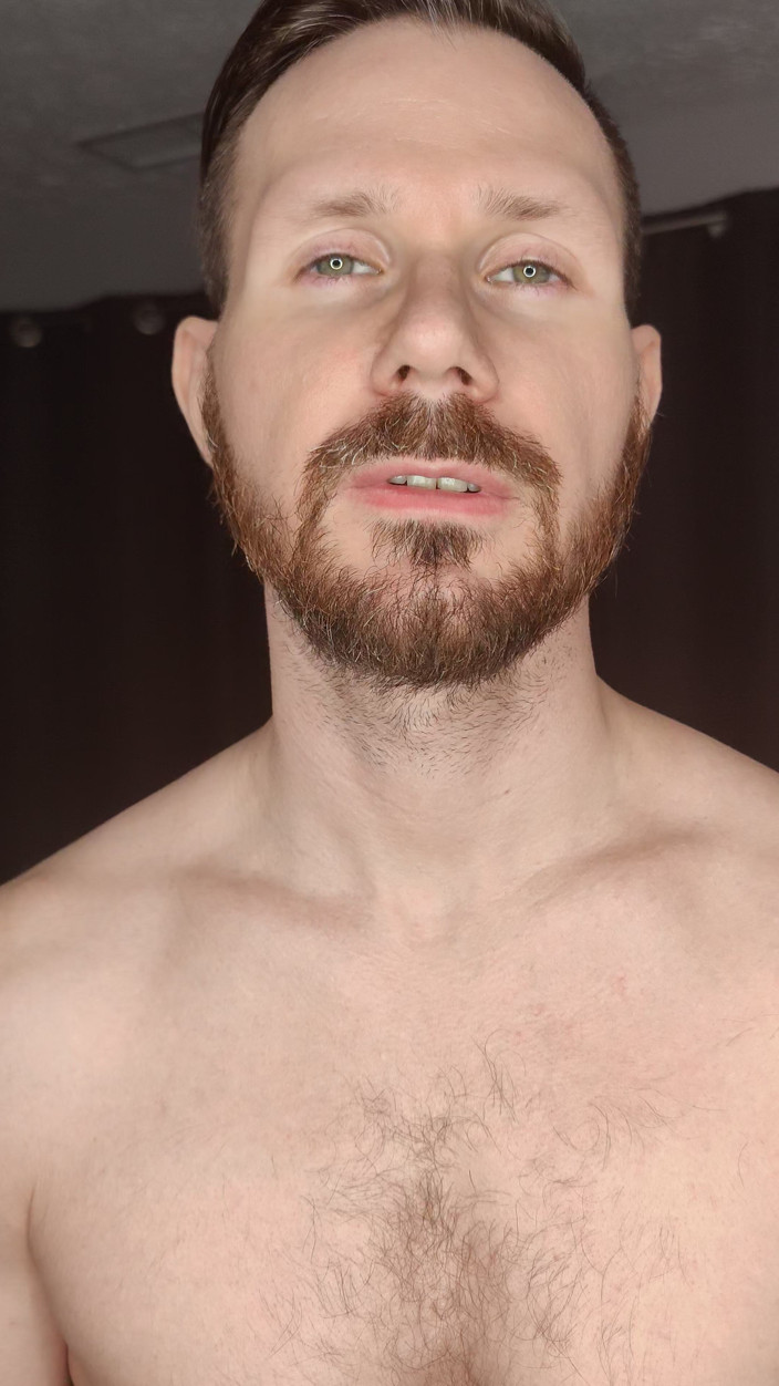 Albino Adonis: 환영