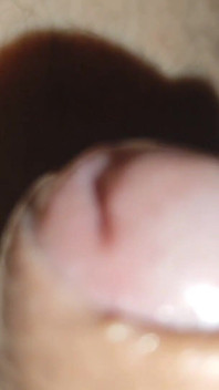 Young Man with Phimosis Opening the Glans