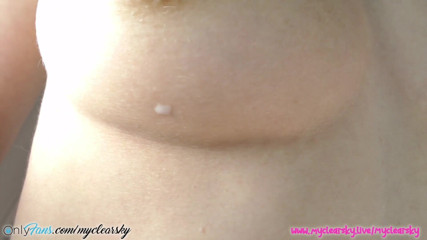 MyClearSky: Lactating hard nipples