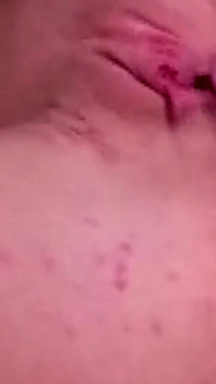 Estremo anale bocciolo di rosa Prolasso - gocciolante e serrando selvaggiamente