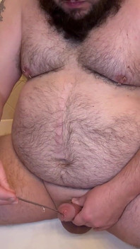 Pierced Chubby Guy Sounding with 3mm - 4mm and 5mm - 6mm Hegar