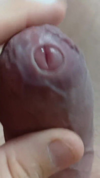Big Uncut Tight Forskin Cock - Phimosis, Short Cock Play