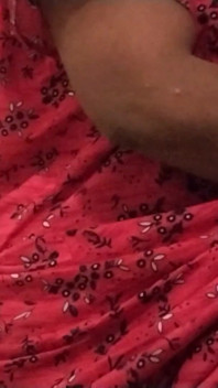 Hot Leg