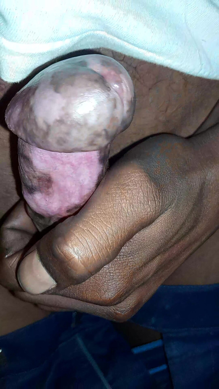 AKG: Masturbace desi muže