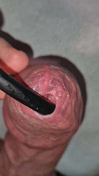 Phimosis Tight Foreskin Wet Play