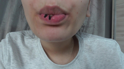 AmayaMori: Ma demi-sœur géante joue au dentiste avec son demi-frère minuscule,