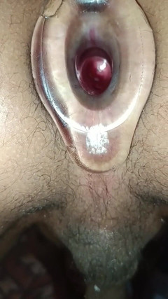 MiguellTrajano: Mông tôi bây giờ nóng bỏng