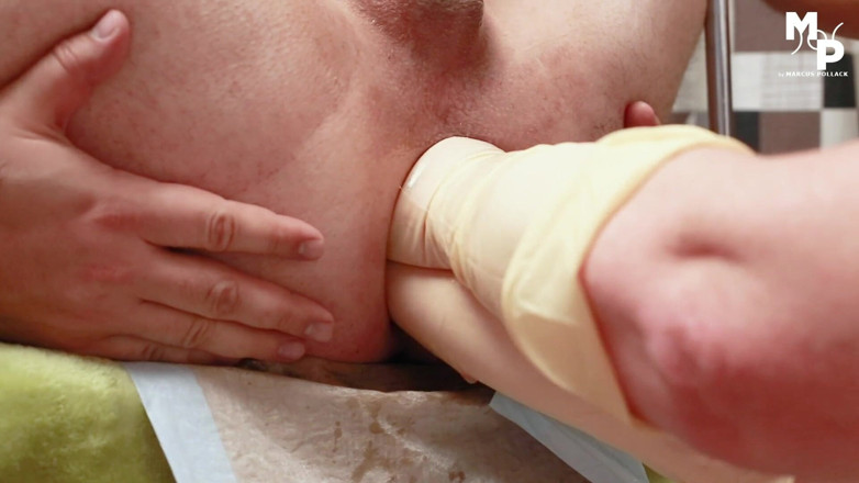 Marcus Pollack: Pomalé dvojité fisting od mé přítelkyně