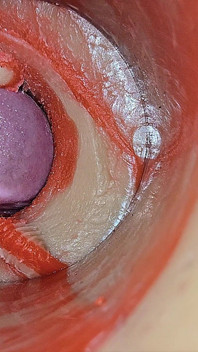 Female Insemination - Internal Camera Captures Deep Male Huge Ejaculation