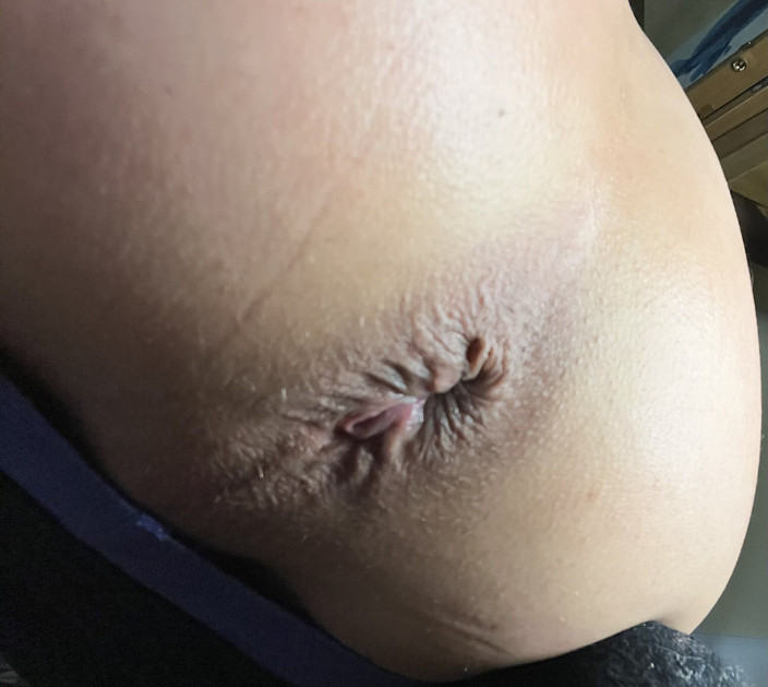 Stacey Loves Anal xxx: Staceylovesanal, vibromasseur, cul, éjaculation, auto-baise