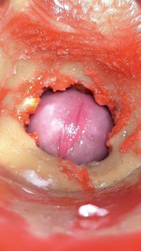 Telecamera in Anale Cervix POV, Piccolo Cornuto Da 'coppia' Gigante, Sborra in Anale E Creampie - Asmr