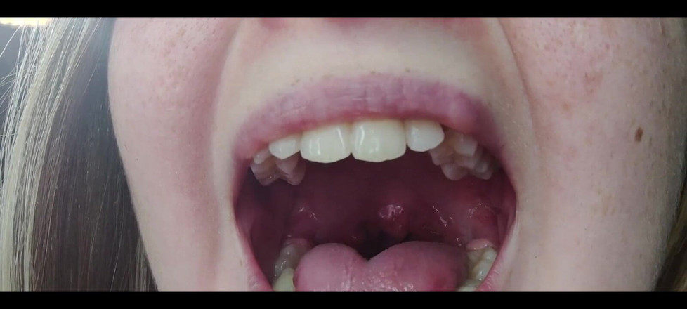 RavenHearth666VIP: Fetiș cu gât