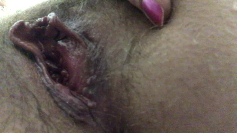 Risky Hairy Couple: Moje chlupatá kundička po narození