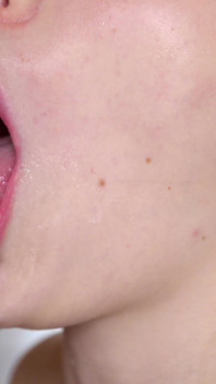 Asmr Sloppy Deepthroat Close-up with Braces: Drenched in Spit