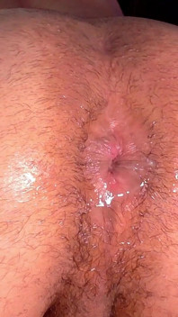 Gaping Open Hole
