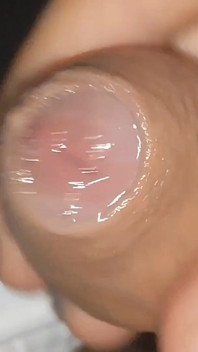 Curious Close-up of Pre-cum in Flaccid Phimosis.