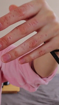 Biting Fingers for the First Time