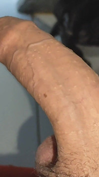 Big Uncircumcised Dick Opening Phimosis of the Glans.