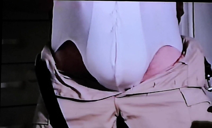 Monster_Meat_: Bulging in my shinos