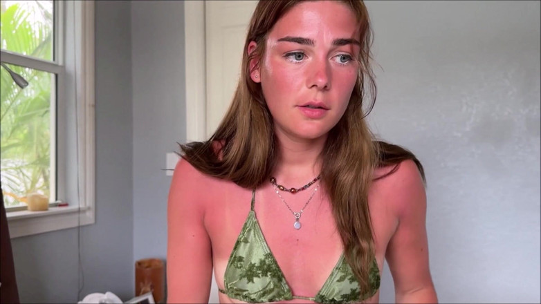 Alex Adams: Little Stepsister's Sunburn Accident - Arabella Rose - Family Therapy