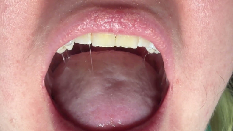 Spunk Kip: Mouth &amp; Tonsils Close-up