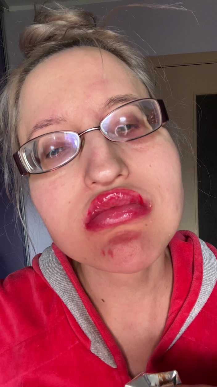 FinDom Goaldigger: Obří velké rty Velké brýle Asmreating Snickers Protein Bar