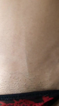 Abs Veins