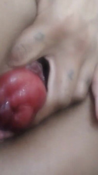 Prolapse Training