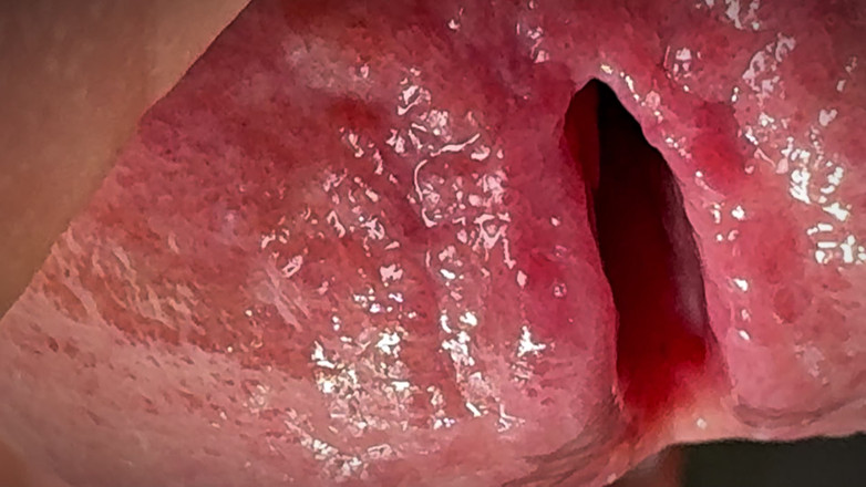 Leonardo-1974: Kencing di testis