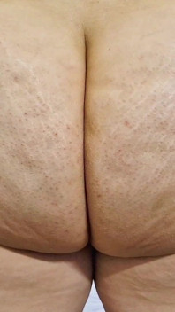 Sniff My Ass