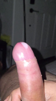 Abspritzen