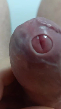 Big Uncut Tight Forskin Cock - Phimosis, Short Cock Play