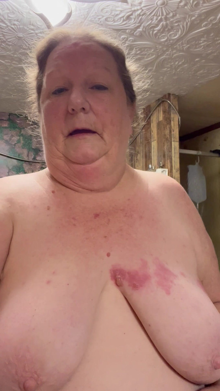 PlayfulRose1: Kes Buruk Shingles