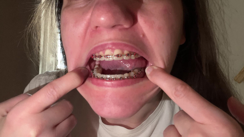 NicoleRay: Menjilati kawat gigi dengan lidah Anda