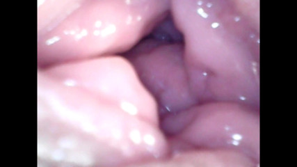 LizAngel: Encore une endoscope dans mon vagin