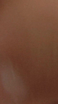Amazing Closeup of the Widened Hole!!