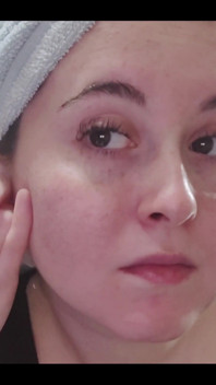 My ear cleaning routine starts with cotton swabs and then gauze.