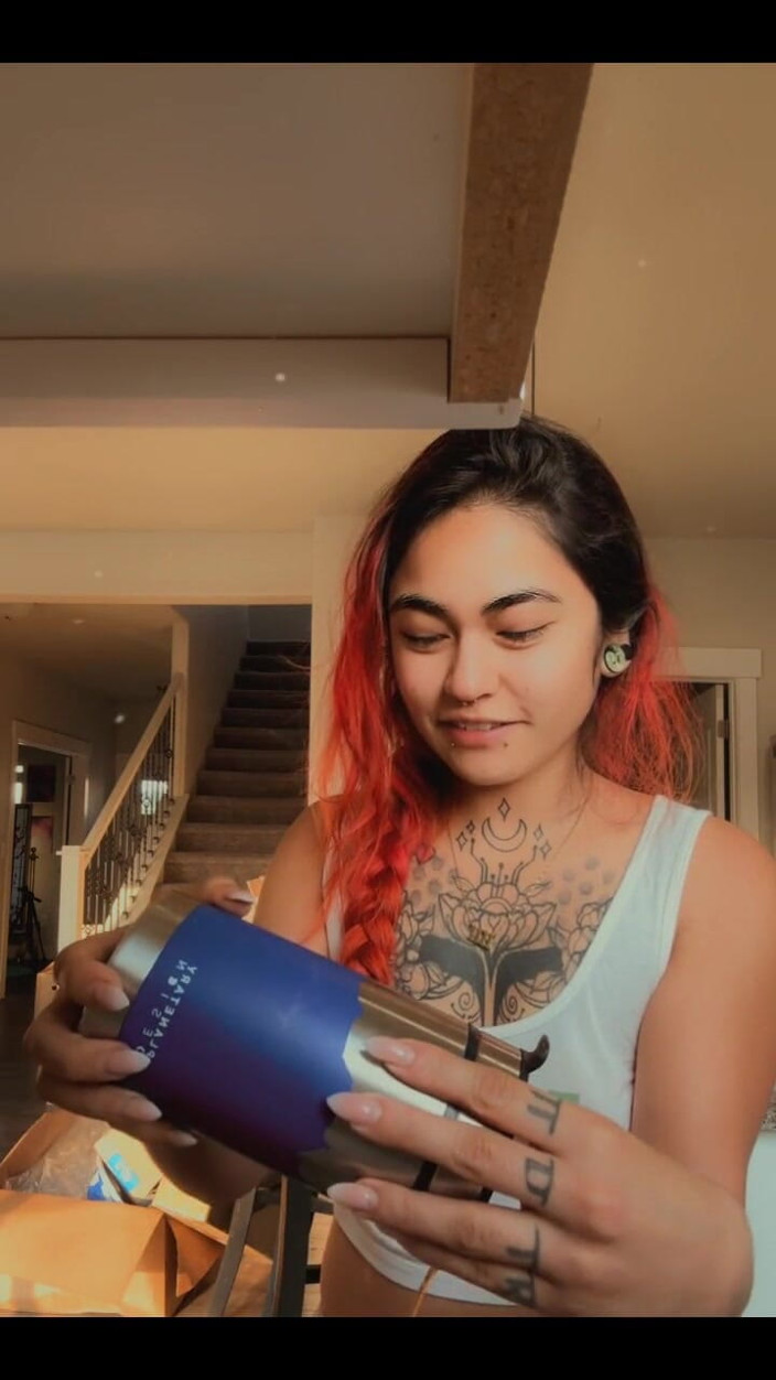 lilRavenFox: Omg a Long Lil Update My Foot Is Healing!