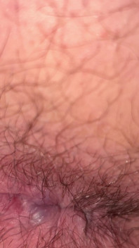 Close up Hairy Hole