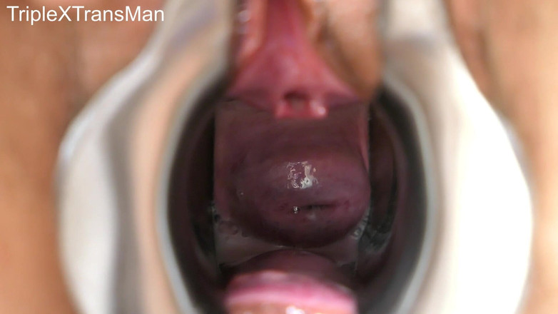 TripleXTransMan: 子宮頸部に挿入!