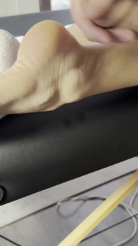 The Lollipop Couldn’t Handle the Pressure