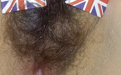 England Hairy