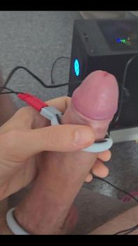 Electro Cock Shock Experiment