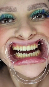 Cleaning Teeth with Toothbrush, Irrigator, Dental Hook