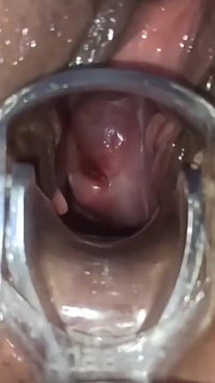 Masturbatie met baarmoederzicht en medische speculum, close-up van mijn poesje
